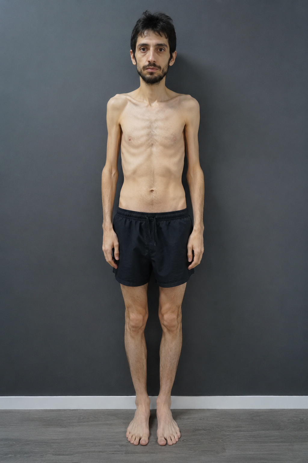 Corpo magro e flácido